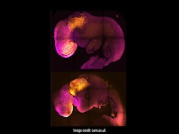 Scientists Create World's First "Synthetic" Embryo With Brain, Beating Heart: Report Scientists Create World's First "Synthetic" Embryo With Brain, Beating Heart: Report