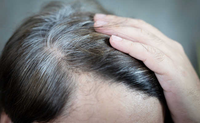 क्या आप भी White Hair के साथ Hair Fall से हैं परेशान, तो जानें Post COVID साइड इफेक्ट को ठीक करने का उपाय