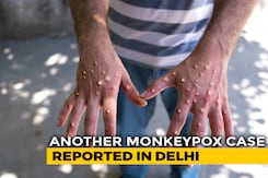 Third Monkeypox Case In Delhi, 8 In India So Far: Health Minister Third Monkeypox Case In Delhi, 8 In India So Far: Health Minister