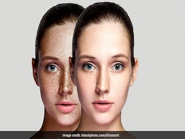 इस चाय को लगाने से चेहरे की झाइयां हो जाती हैं गायब, फेस हो जाता है ग्लोइंग, यहां जानिए उसका नाम इस चाय को लगाने से चेहरे की झाइयां हो जाती हैं गायब, फेस हो जाता है ग्लोइंग, यहां जानिए उसका नाम