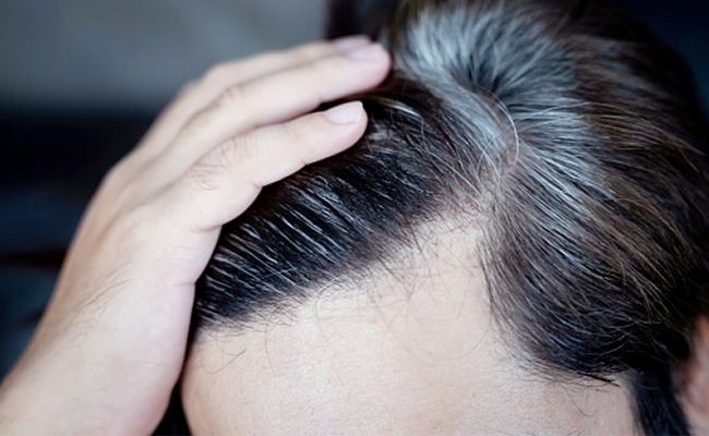 बिना मेहंदी के घर पर बनाइए हेयर डाई, पुराने सफेद बाल भी दिखने लगेंगे काले और खूबसूरत 