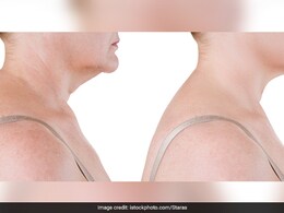 गर्दन की चर्बी को कम करना है तो करिए यह एक एक्सरसाइज, 15 दिन में दिखेगा असर गर्दन की चर्बी को कम करना है तो करिए यह एक एक्सरसाइज, 15 दिन में दिखेगा असर