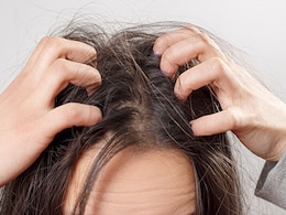 इन 4 DIY स्कैल्प स्क्रब से इचिंग या डैंड्रफ से मिल जाएगा छुटकारा इन 4 DIY स्कैल्प स्क्रब से इचिंग या डैंड्रफ से मिल जाएगा छुटकारा