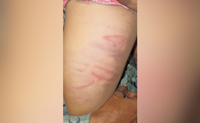 Tuition Teacher Brutally Beat Up Girls, Delhi Commission For Women Seeks Report From Police - बच्चियों की पिटाई को लेकर एक्शन में दिल्ली महिला आयोग, पुलिस से मांगी रिपोर्ट | India In Hindi