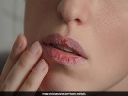 Pregnancy के दौरान होती है होंठ सूखने की दिक्कत, तो इन 7 तरीकों से करें रूखापन दूर  Pregnancy के दौरान होती है होंठ सूखने की दिक्कत, तो इन 7 तरीकों से करें रूखापन दूर