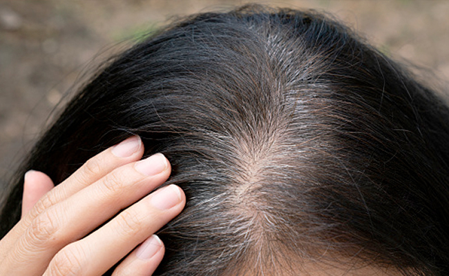 इन 3 तरीकों से लगा लिया प्याज तो बाल होने लगेंगे काले, जान लीजिए सफेद बालों के लिए Onion Juice के नुस्खे 