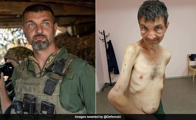 Ukraine Releases Shocking Before And After Pictures Of Soldier Captured By Russians