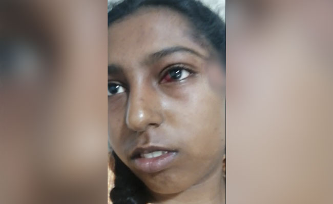 Hyderabad Teen Injured In Chaotic India vs Australia Match Ticket Sales