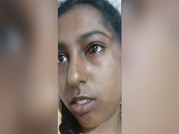 Hyderabad Teen Injured In Chaotic India vs Australia Match Ticket Sales Hyderabad Teen Injured In Chaotic India vs Australia Match Ticket Sales