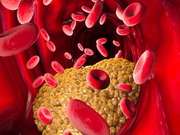 Cholesterol Diet: खून और नसों में जमें कोलेस्ट्रॉल से छुटकारा पाने के लिए खाएं ये 5 फल, हार्ट के लिए भी फायदेमंद Cholesterol Diet: खून और नसों में जमें कोलेस्ट्रॉल से छुटकारा पाने के लिए खाएं ये 5 फल, हार्ट के लिए भी फायदेमंद