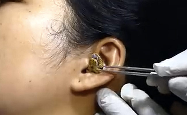 Video: Snake Gets Stuck In Woman's Ear, Leaving Internet Stunned