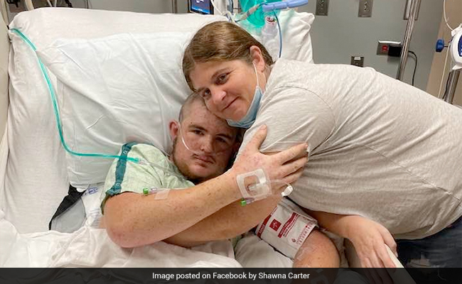 US Man Out Of Coma After Being Stung 20,000 Times By African Killer Bees