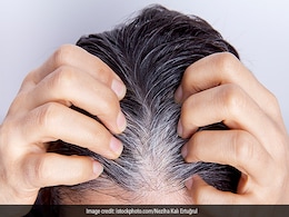 काले बालों के बीच सफेद बाल चमकने लगे हैं तो रात में नाभि में लगा लें ये तेल, जड़ से काले हो जाएंगे सारे उजले बाल काले बालों के बीच सफेद बाल चमकने लगे हैं तो रात में नाभि में लगा लें ये तेल, जड़ से काले हो जाएंगे सारे उजले बाल