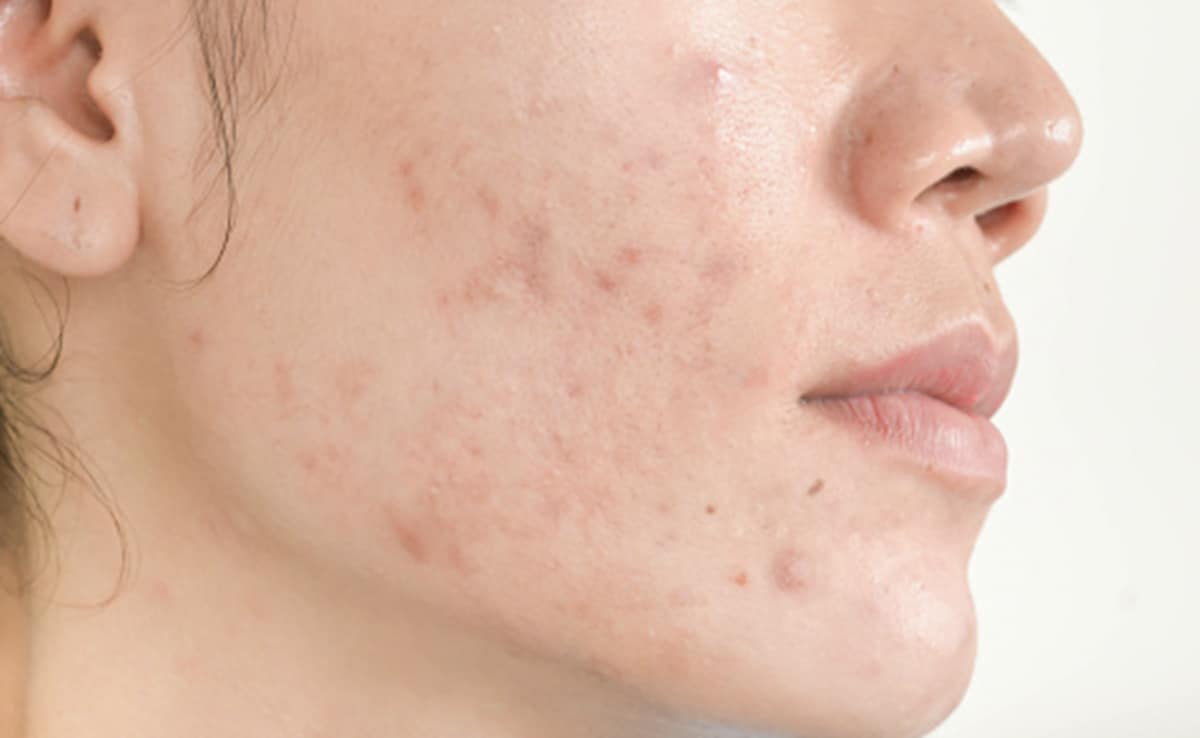 Add image caption here Add image caption here