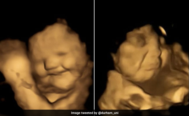 Babies In The Womb Smile For Carrots But Grimace Over Kale, Study Finds