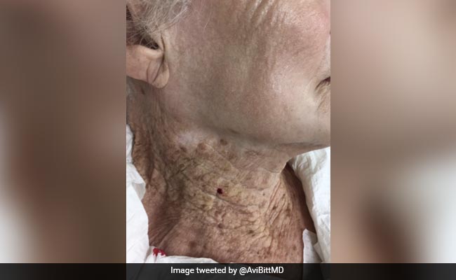 Woman Used Sunscreen On Her Face But Avoided Neck. Photo Shocks Internet