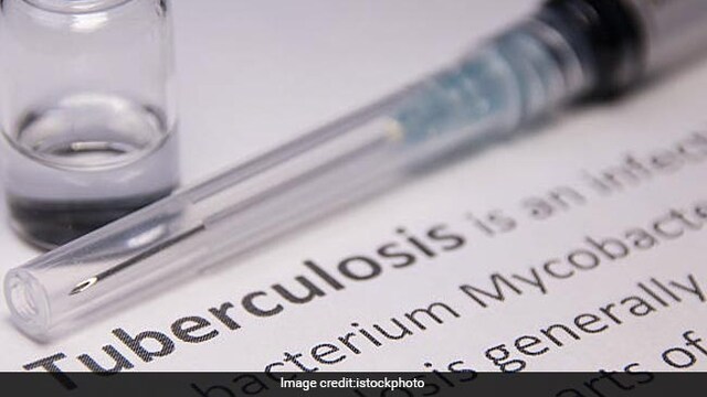 Tuberculosis Cases In India Drop By 21%, Almost Double The Rate Of Decline Globally