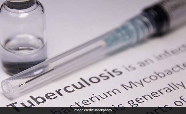 Tuberculosis Cases In India Drop By 21%, Almost Double The Rate Of Decline Globally