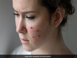 Skin Care Mistakes: ट्रेंड देखकर गलती से भी ना लगा लें चेहरे पर ये 6 चीजें, पड़ सकता है पछताना  Skin Care Mistakes: ट्रेंड देखकर गलती से भी ना लगा लें चेहरे पर ये 6 चीजें, पड़ सकता है पछताना