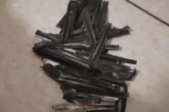 Watch: 63 Steel Spoons Removed From Man's Stomach In Uttar Pradesh Watch: 63 Steel Spoons Removed From Man's Stomach In Uttar Pradesh