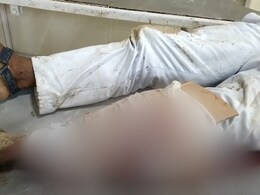 MP में बदहाल अस्पतालों का नमूना : फ्रैक्चर होने पर प्लास्टर की जगह बांध दिया 'कागज का गत्ता' MP में बदहाल अस्पतालों का नमूना : फ्रैक्चर होने पर प्लास्टर की जगह बांध दिया 'कागज का गत्ता'