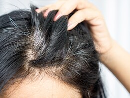 प्याज के रस में ये 2 चीजें मिलाकर लगा लीं सफेद बालों पर, तो जड़ से काली होने लगेंगी आपकी लटें 