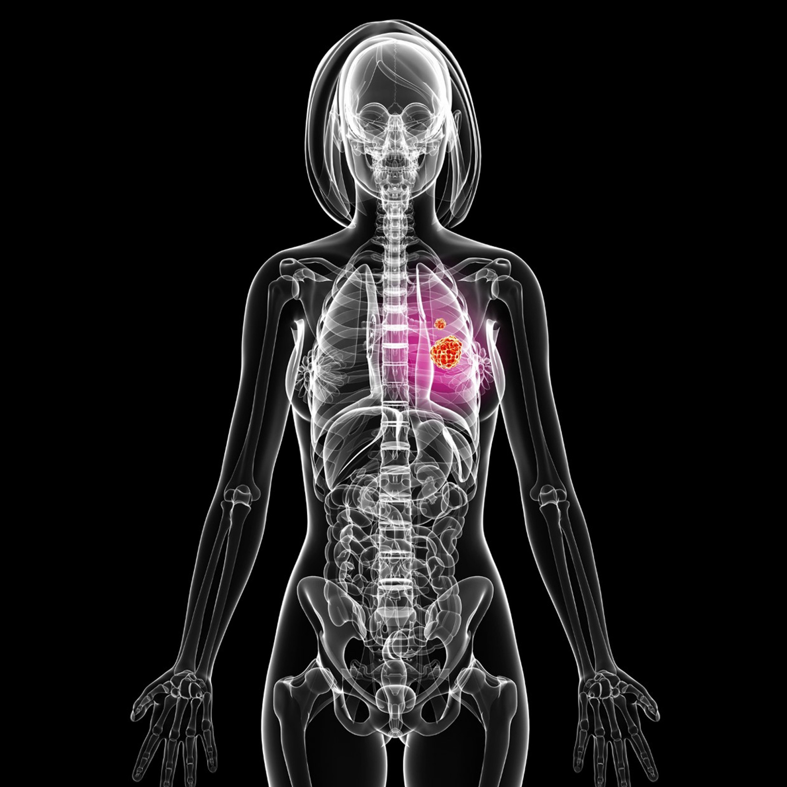 Woman Survived Cancer 12 Times, Her Genes Surprise Experts