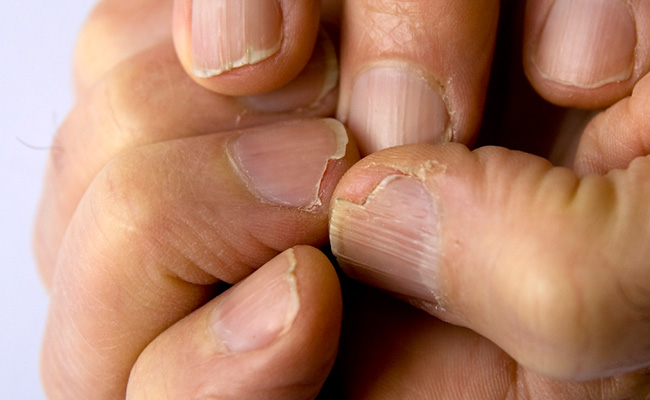 इन 4 तरह के तेलों से नाखून होते हैं लंबे, जानिए इनके नाम और इस्तेमाल करने का सही तरीका 