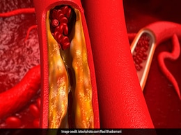 Heart Health: Make These 5 Lifestyle Changes To Reduce Bad Cholesterol Heart Health: Make These 5 Lifestyle Changes To Reduce Bad Cholesterol