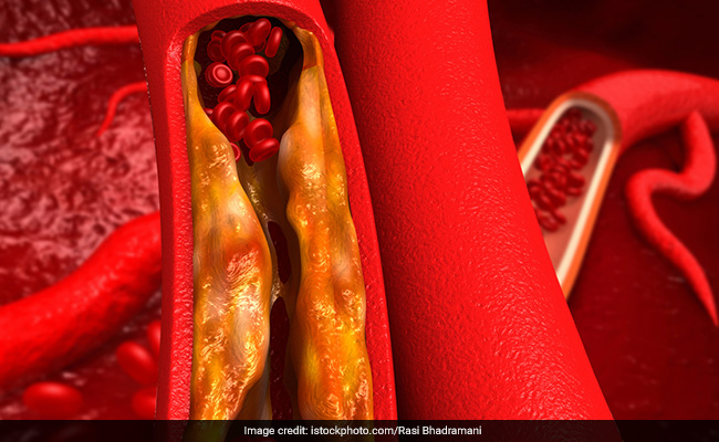 A healthy diet and lifestyle can help maintain cholesterol levels