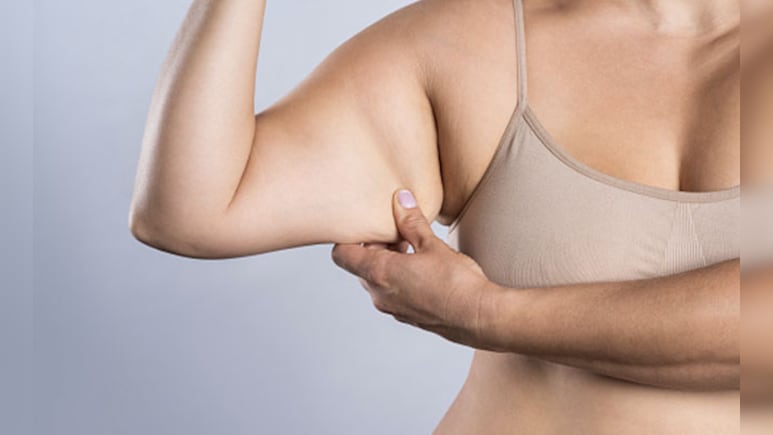 आर्म फैट घटाने के 5 असरदार तरीके, वजन कम करने के साथ बाजुओं को भी बनाएं टाइट और सुडौल