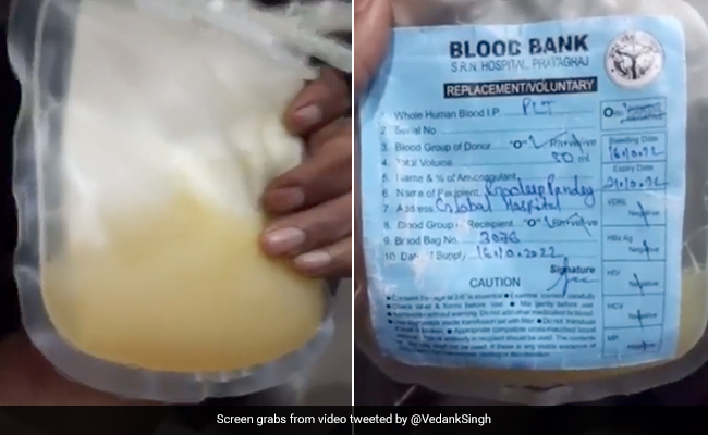 Viral Video Claims Dengue Patient Died After Mosambi Juice Drip In UP, Probe Ordered