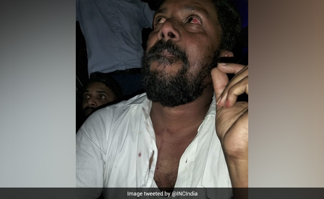 गुजरात: चुनावी सभा में जा रहे कांग्रेस के दलित MLA को पीटा, कार पर फेंके पत्थर; बोले- BJP वालों ने गालियां भी दीं