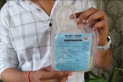 "Poorly Preserved Platelets", Not "Mosambi Juice": UP Official On Hospital Death "Poorly Preserved Platelets", Not "Mosambi Juice": UP Official On Hospital Death