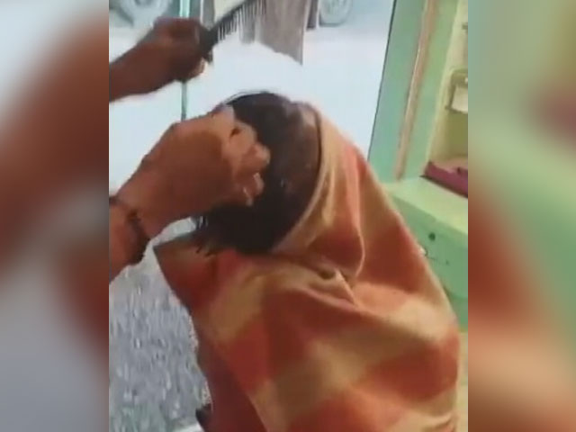 "Fire Haircut" Attempt Goes Wrong, Gujarat Man Suffers Serious Burns