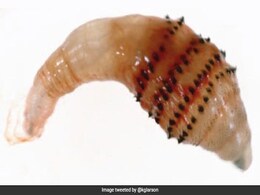 Woman Finds Maggot-Like Parasite In Arm Wound After Trip To South America: Report Woman Finds Maggot-Like Parasite In Arm Wound After Trip To South America: Report
