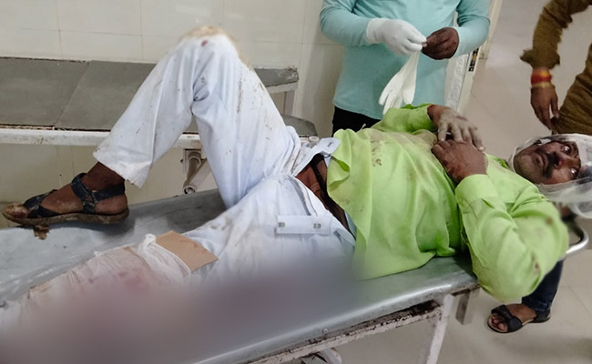 "Not Wrong": Madhya Pradesh Official's Reply On Cardboard Used As Splint