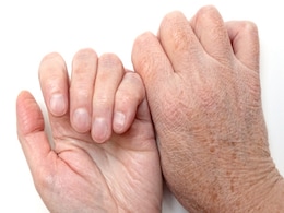 Vitamin C की कमी से शरीर पर दिखने लगते हैं कुछ निशान, इस तरह पहचानें विटामिन सी के लक्षण Vitamin C की कमी से शरीर पर दिखने लगते हैं कुछ निशान, इस तरह पहचानें विटामिन सी के लक्षण