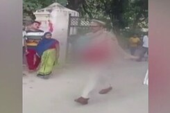 Video: In UP Shocker, Injured Girl Wants Help, People Busy Filming Her Video: In UP Shocker, Injured Girl Wants Help, People Busy Filming Her