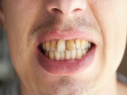 Teeth Cleaning Tips: पीले दातों को सफेद कैसे बनाएं, जानें दांतों से टार्टर और प्लाक हटाने के घरेलू  नुस्खे... Teeth Cleaning Tips: पीले दातों को सफेद कैसे बनाएं, जानें दांतों से टार्टर और प्लाक हटाने के घरेलू  नुस्खे...