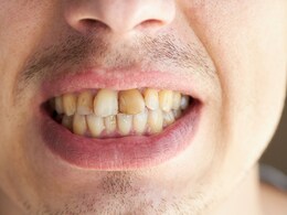 दांतों पर जमी पीली परत को निकालकर दांत मोती की तरह साफ कर देगा यह सफेद पाउडर 