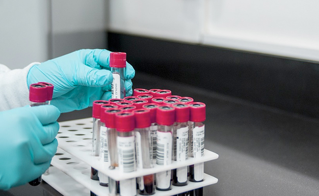 UK Researchers Give Lab-Grown Blood To Humans In World-First Clinical Trial