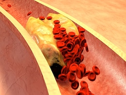 5 दिन खाएं ये 5 चीजें, खून से निकल जाएगा गंदा Cholesterol, महज दो हफ्तों में दिखेगा असर 5 दिन खाएं ये 5 चीजें, खून से निकल जाएगा गंदा Cholesterol, महज दो हफ्तों में दिखेगा असर