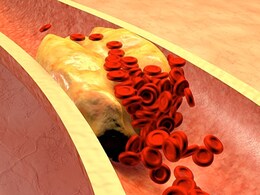 Bad Cholesterol: शरीर से खराब कोलेस्ट्रॉल को निकाल बाहर कर देगा ये हरा पत्ता, यहां जानें कैसे करें सेवन Bad Cholesterol: शरीर से खराब कोलेस्ट्रॉल को निकाल बाहर कर देगा ये हरा पत्ता, यहां जानें कैसे करें सेवन