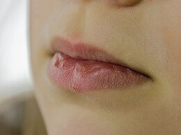 आपके होंठ हो गए हैं रूखे और बेजान, तो इन घरेलू नुस्खों से लिप्स होंगे मुलायम और गुलाबी आपके होंठ हो गए हैं रूखे और बेजान, तो इन घरेलू नुस्खों से लिप्स होंगे मुलायम और गुलाबी