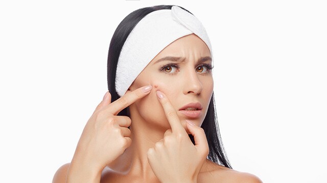 Avoiding the stress that is causing the acne is the greatest method to stop it