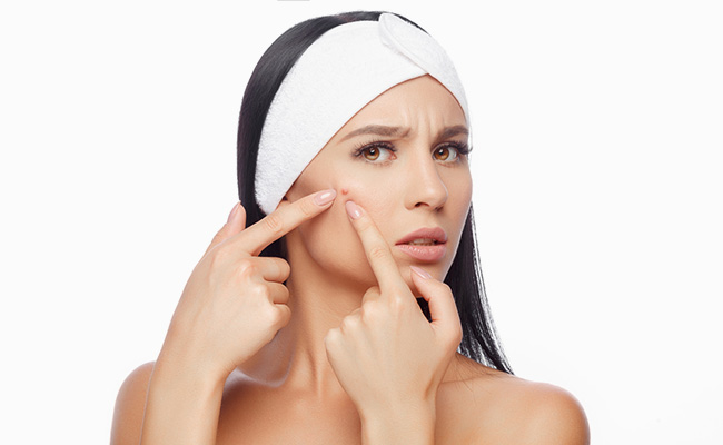 Avoiding the stress that is causing the acne is the greatest method to stop it