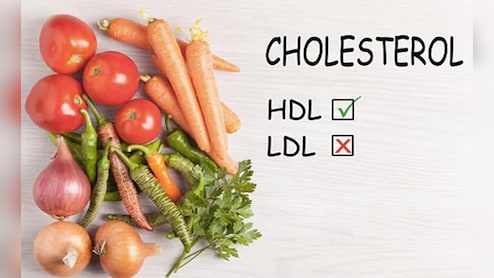 High Cholesterol को फौरन कंट्रोल में लाना है तो हर रोज कर लें ये 3 काम, छू भी नही पाएगी कोई बीमारी