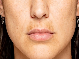 Skin Care Tips: चेहरे से झाइयों को हटाने के 4 प्रभावी घरेलू नुस्खे, दाग धब्बे और झुर्रियां भी हो जाएंगी गायब Skin Care Tips: चेहरे से झाइयों को हटाने के 4 प्रभावी घरेलू नुस्खे, दाग धब्बे और झुर्रियां भी हो जाएंगी गायब