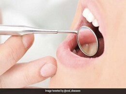 Mouth Diseases Hit Nearly Half The World's Population: WHO Mouth Diseases Hit Nearly Half The World's Population: WHO